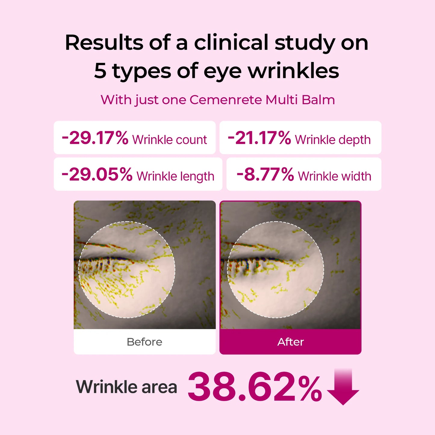 [Tiktok Bestseller] Gifted Collagen Boost Set | Extra 5% OFF